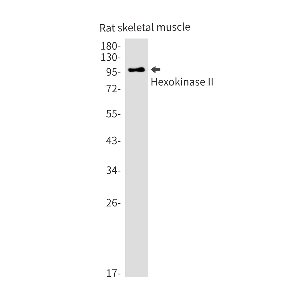 Hexokinase II Rabbit mAb ABZ2391