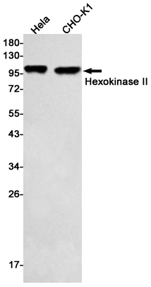 Hexokinase II Rabbit mAb ABZ2391