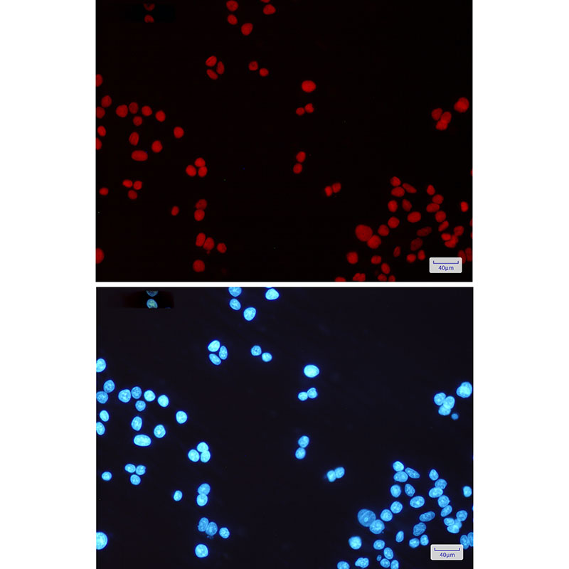 MSH6 Rabbit mAb ABZ2395