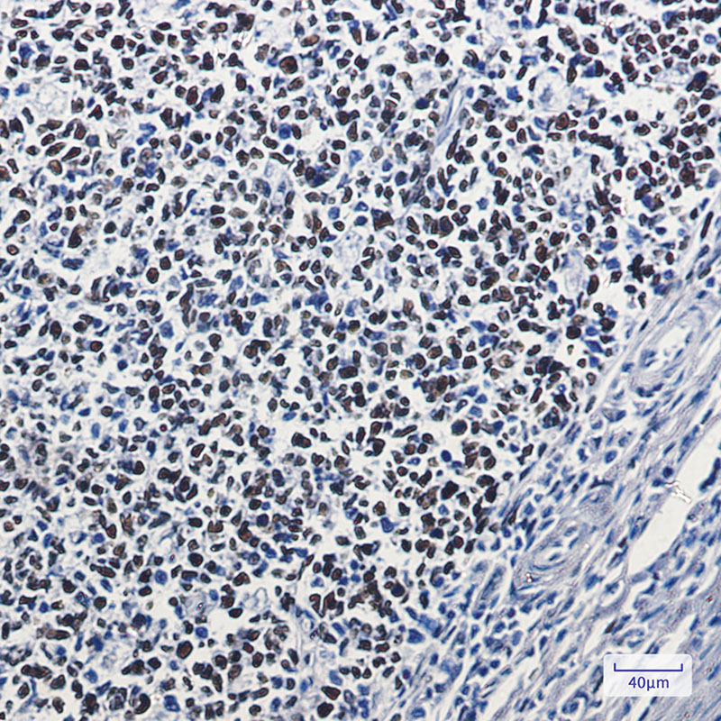 MSH6 Rabbit mAb ABZ2395