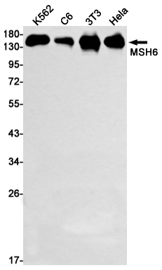 MSH6 Rabbit mAb ABZ2395