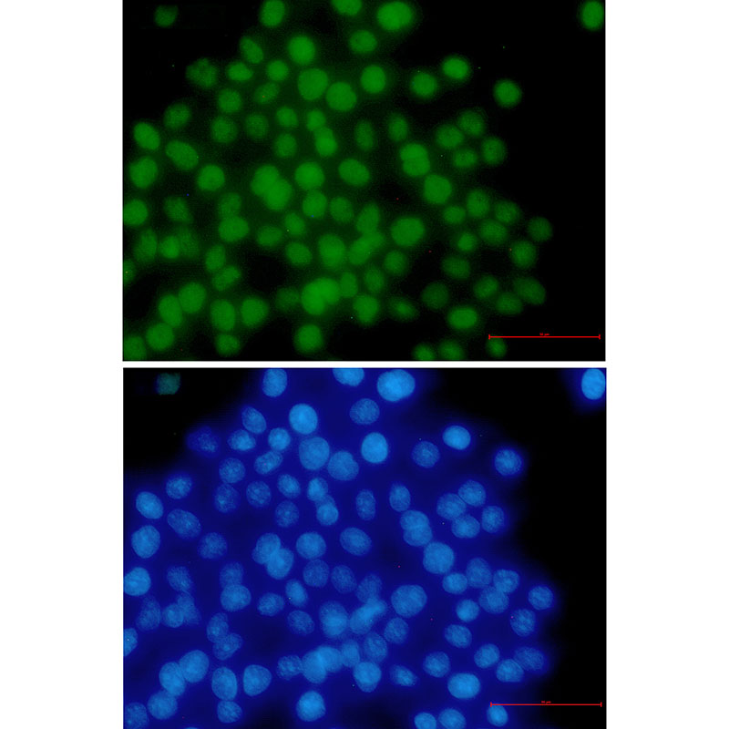 MSH6 Rabbit mAb ABZ2396