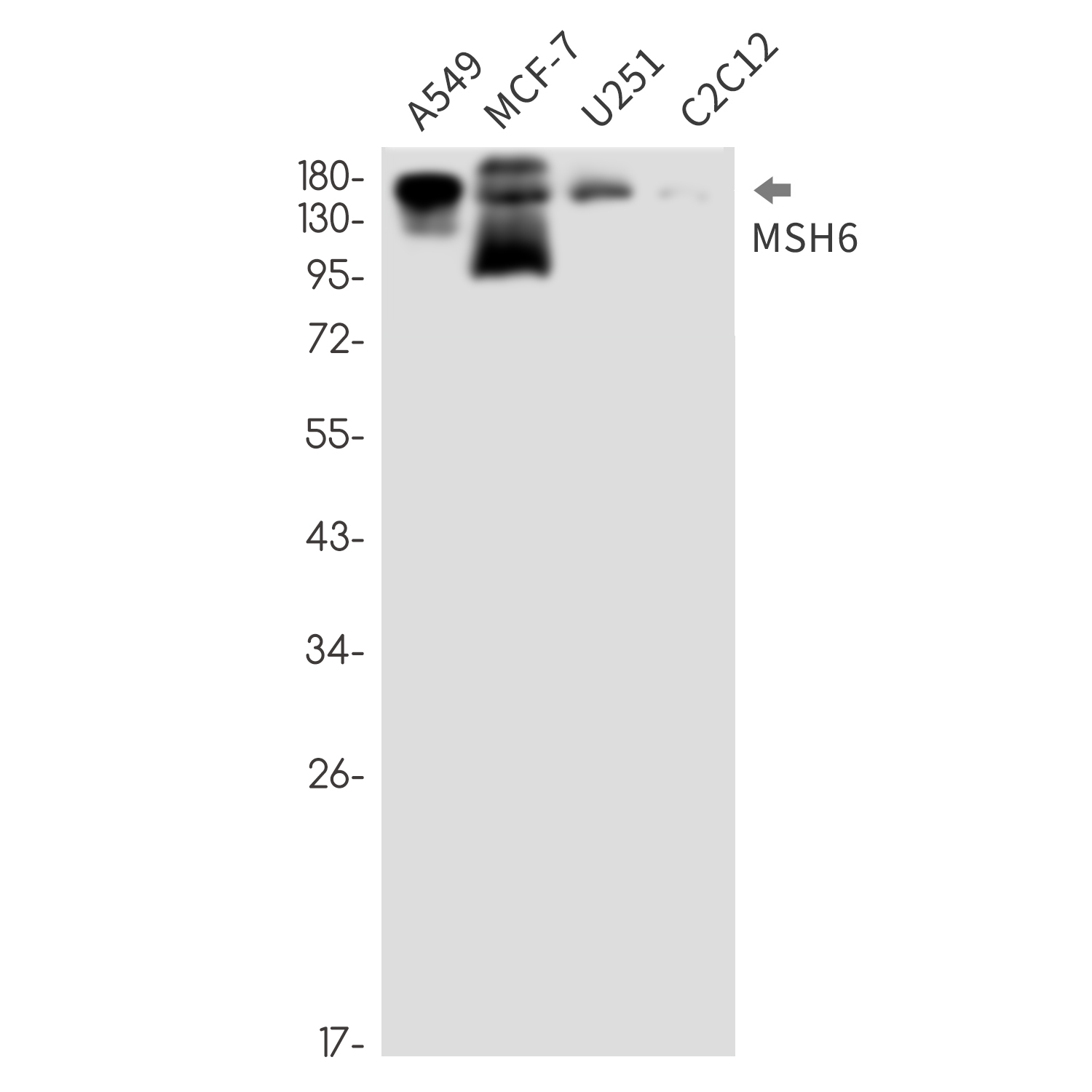 MSH6 Rabbit mAb ABZ2396