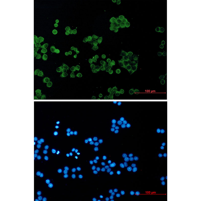 RhoGDI Rabbit mAb ABZ2397
