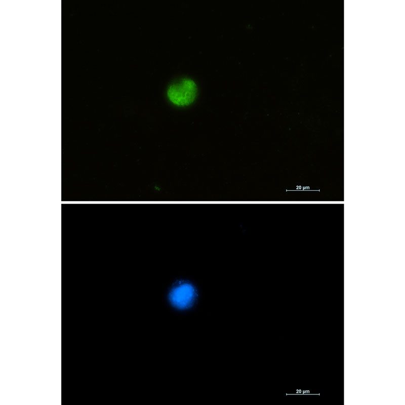 hnRNP M Rabbit mAb ABZ2398