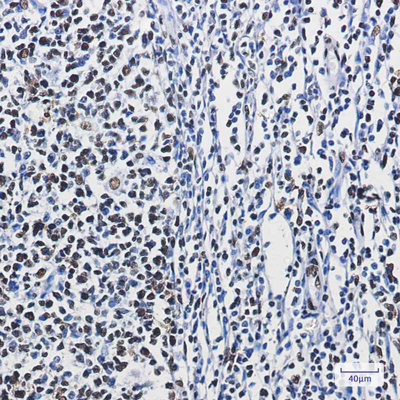 hnRNP M Rabbit mAb ABZ2398