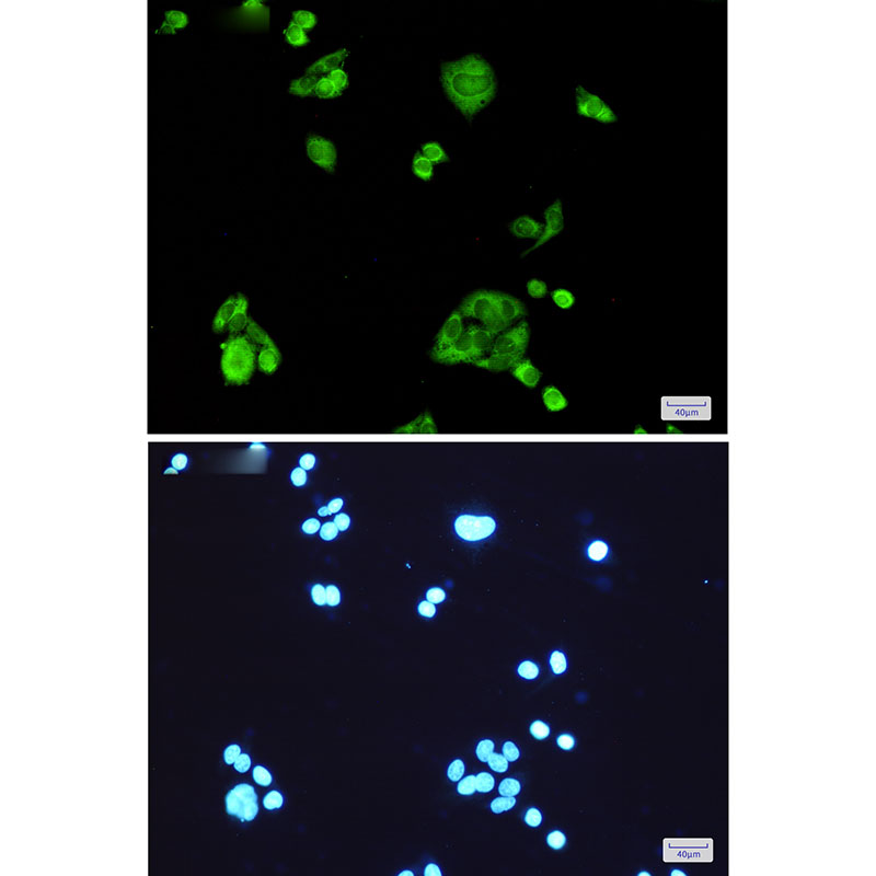 PGD Rabbit mAb ABZ2399