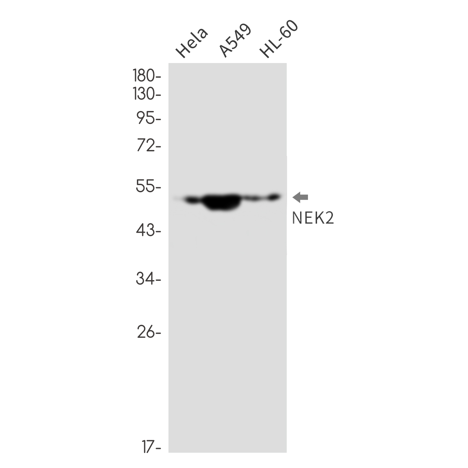NEK2 Rabbit mAb ABZ2400