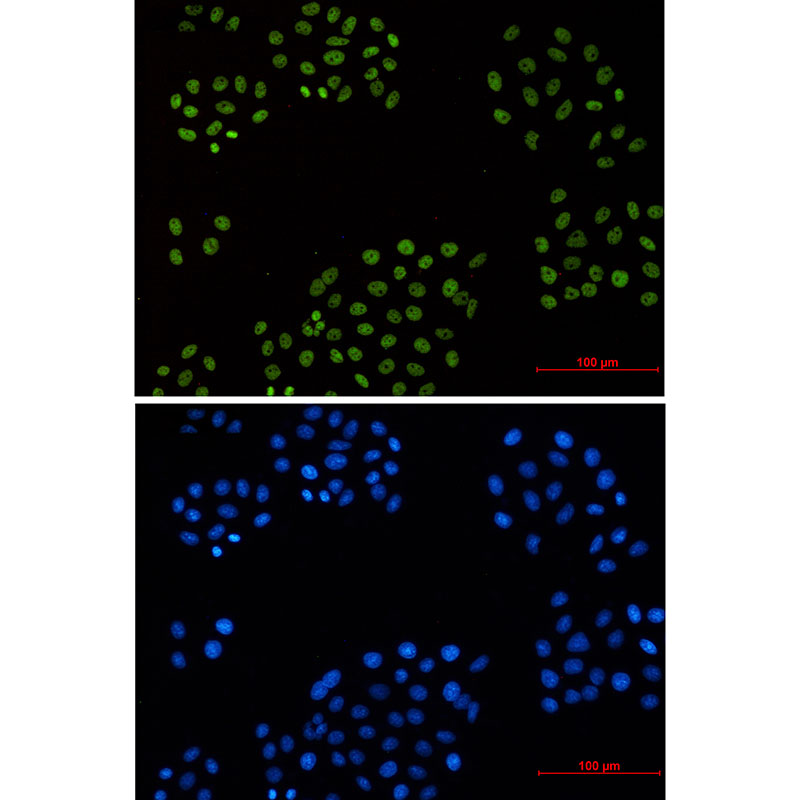Cyclin H Rabbit mAb ABZ2401