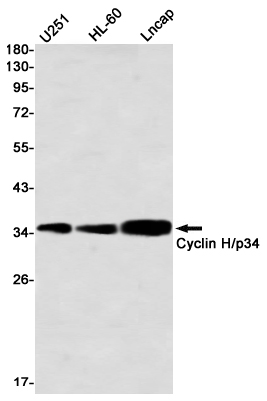 Cyclin H Rabbit mAb ABZ2401