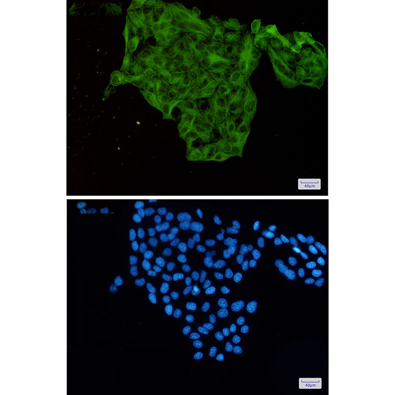 Lumican Rabbit mAb ABZ2403