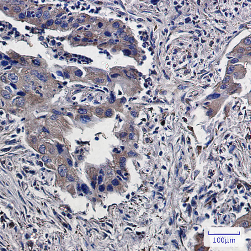 Lumican Rabbit mAb ABZ2403