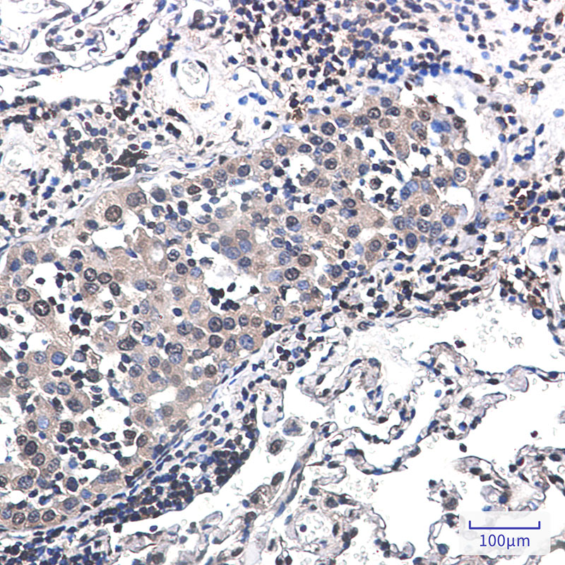 RSK2 Rabbit mAb ABZ2404