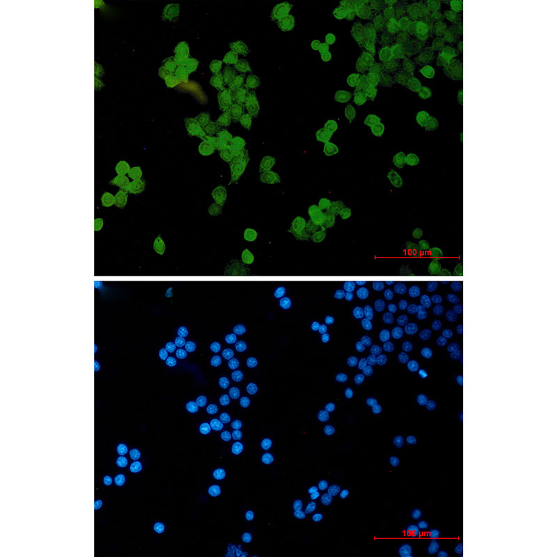 STAT5b Rabbit mAb ABZ2406