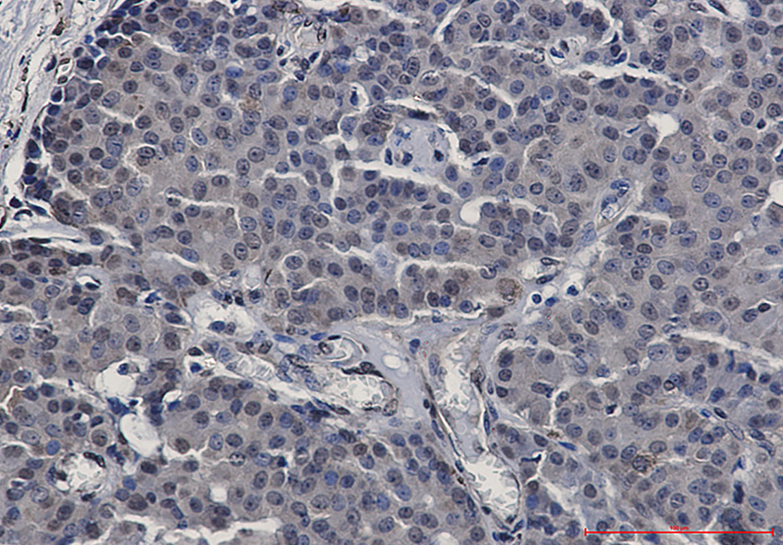 STAT5b Rabbit mAb ABZ2406