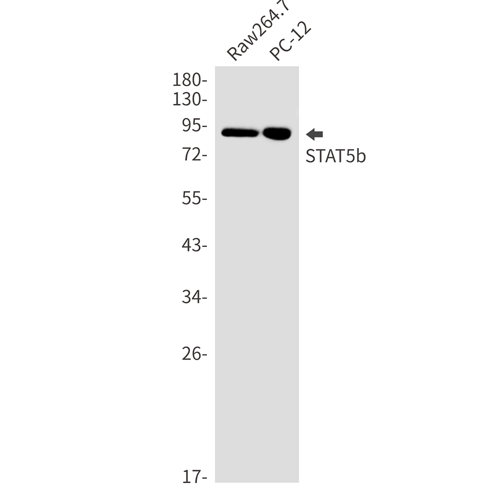 STAT5b Rabbit mAb ABZ2406