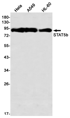 STAT5b Rabbit mAb ABZ2406