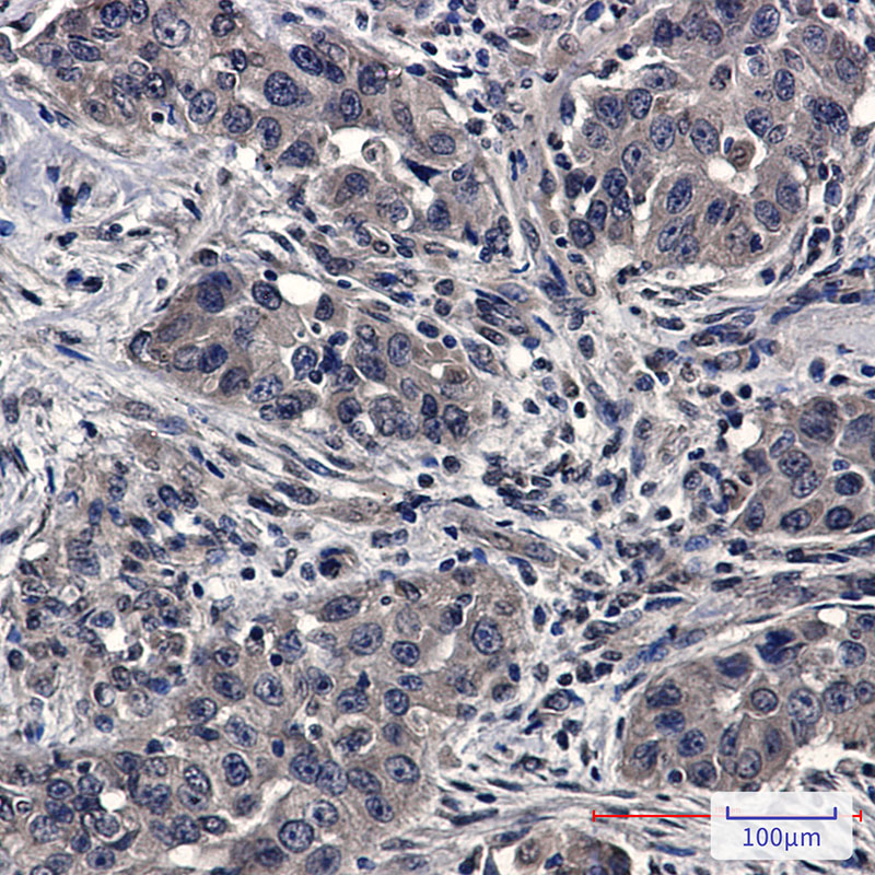 SFT Rabbit mAb ABZ2407