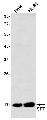 SFT Rabbit mAb ABZ2407