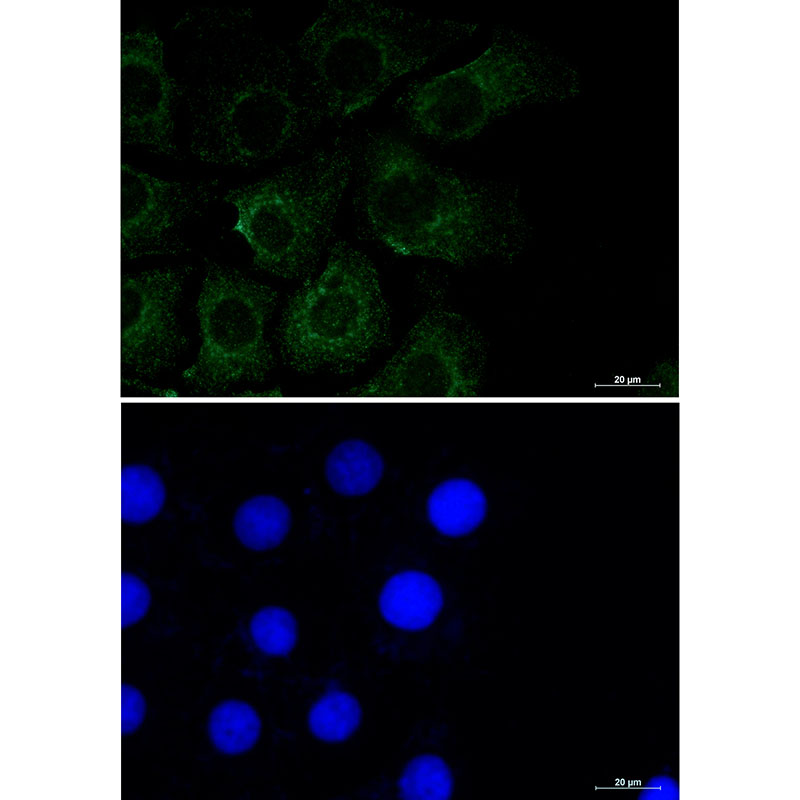 Caveolin-2 Rabbit mAb ABZ2408