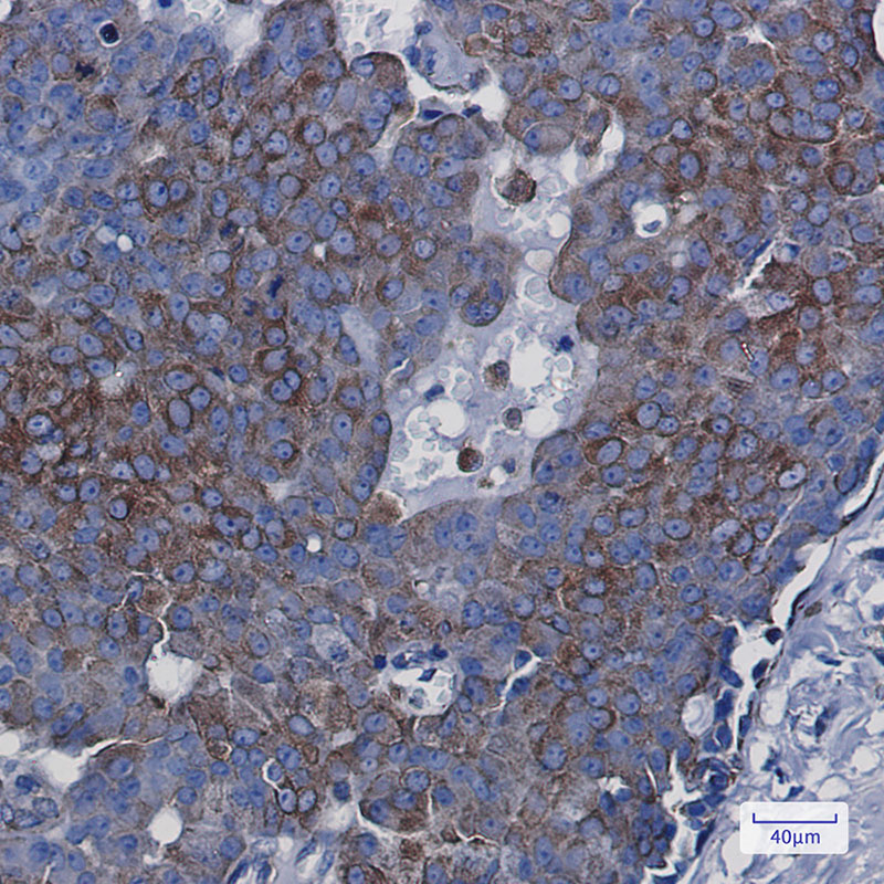 BAP31 Rabbit mAb ABZ2409