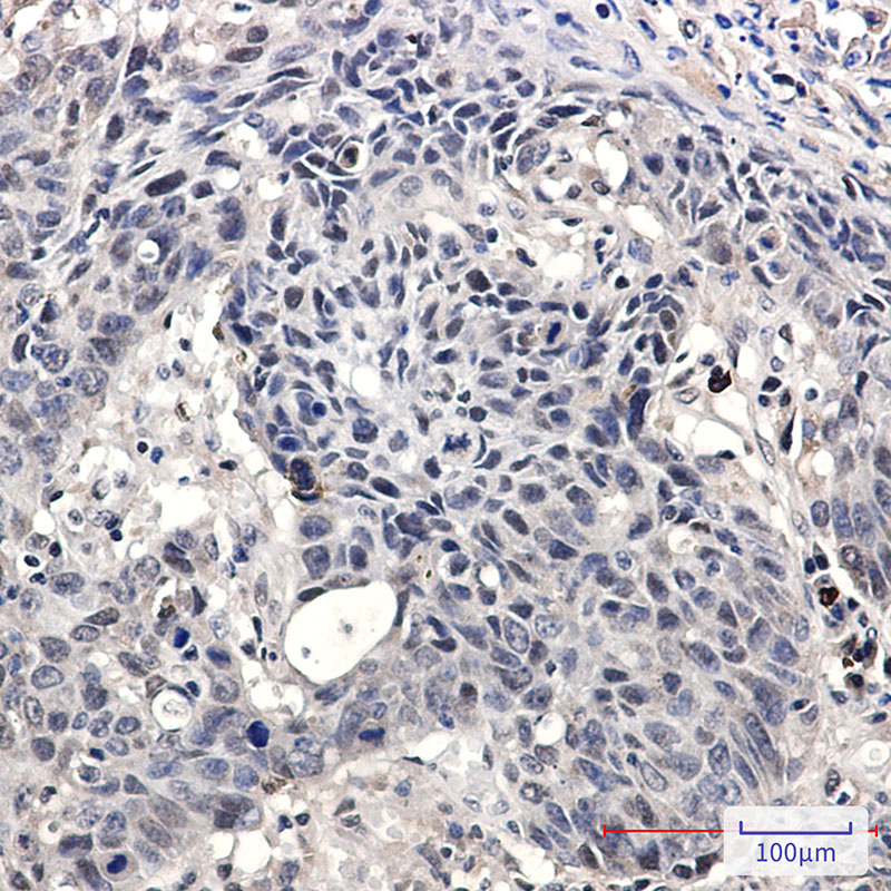 SMARCA2 / BRM Rabbit mAb ABZ2410