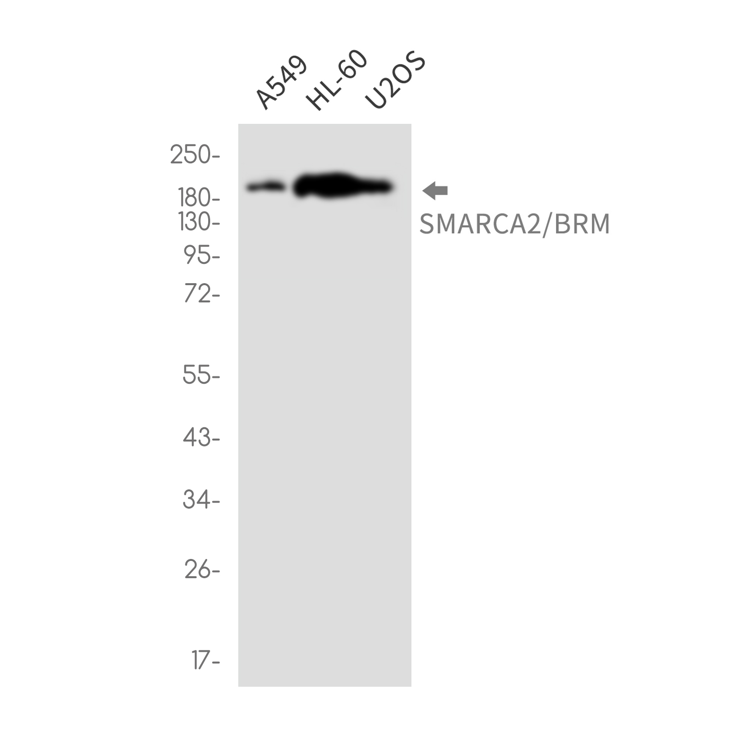 SMARCA2 / BRM Rabbit mAb ABZ2410