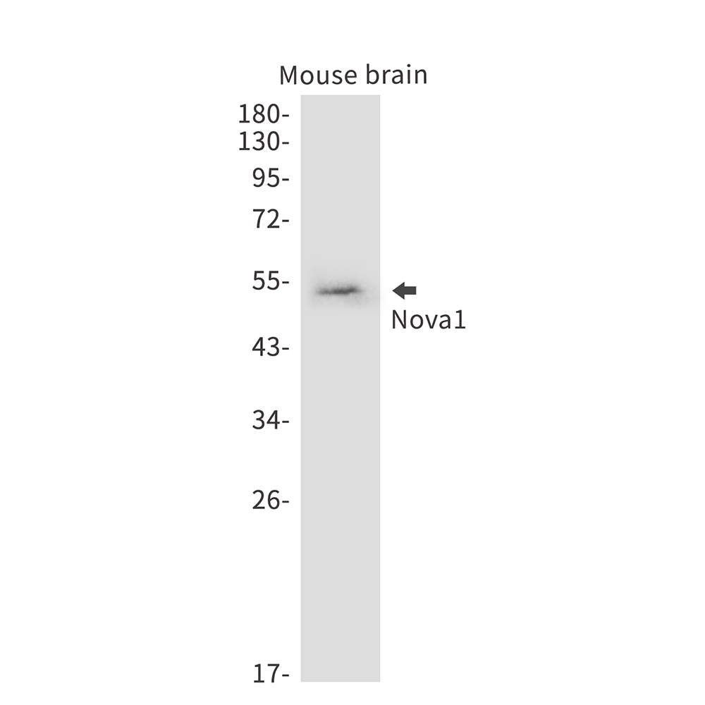 Nova1 Rabbit mAb ABZ2411