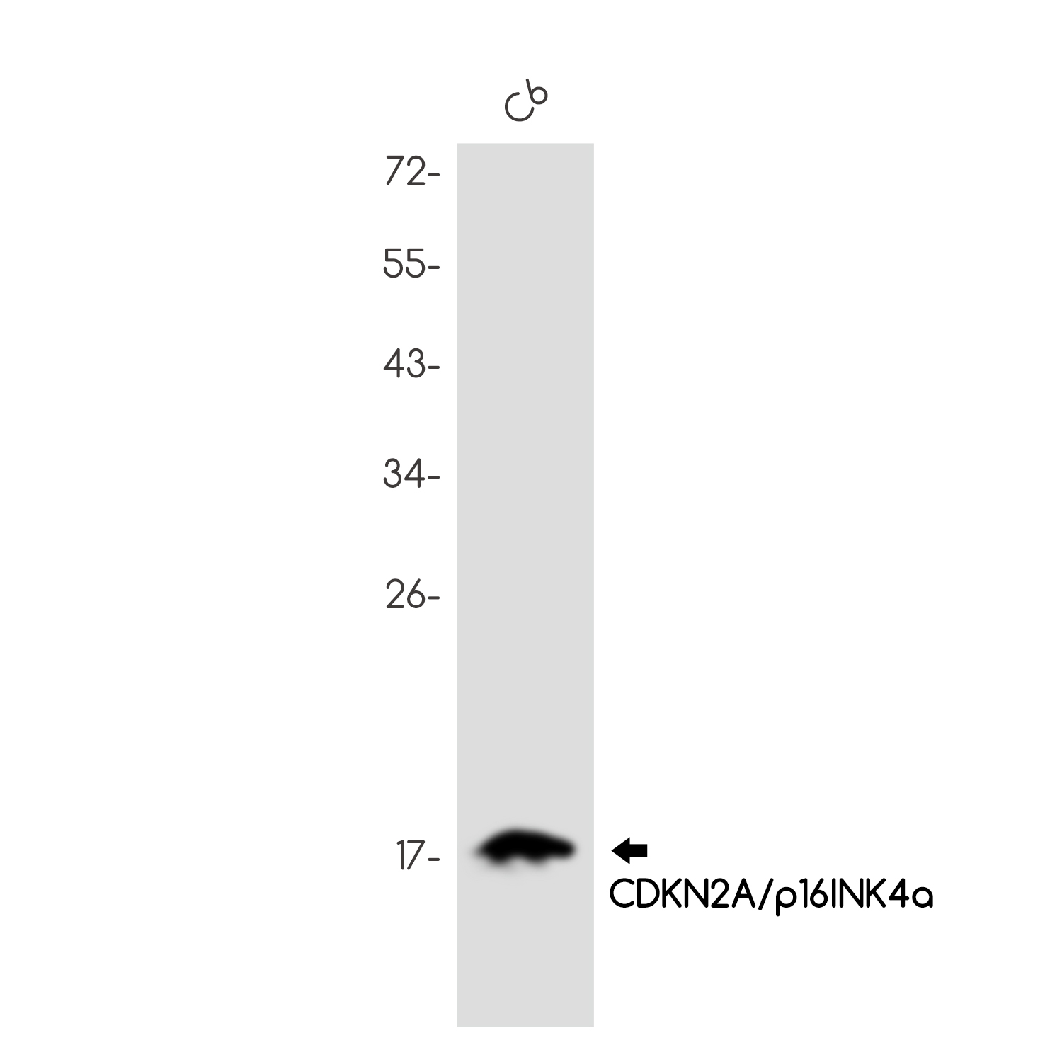 CDKN2A/p16INK4a Rabbit mAb ABZ2412