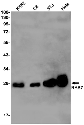 Rab7 Rabbit mAb ABZ2415