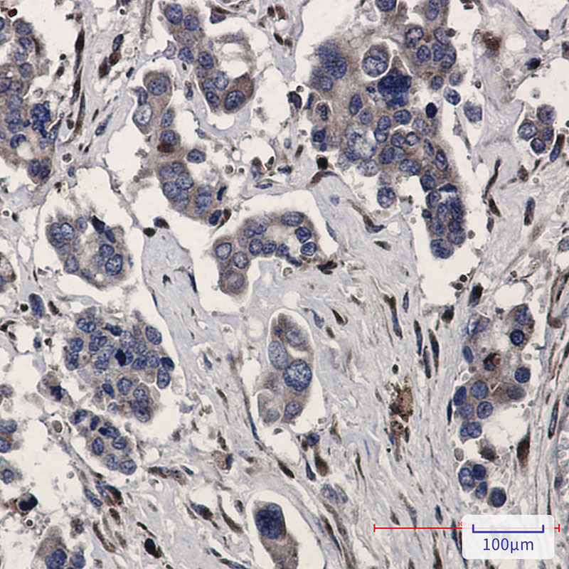 Rab5C Rabbit mAb ABZ2416