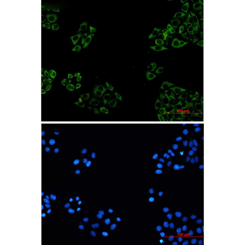 FXR1 Rabbit mAb ABZ2417