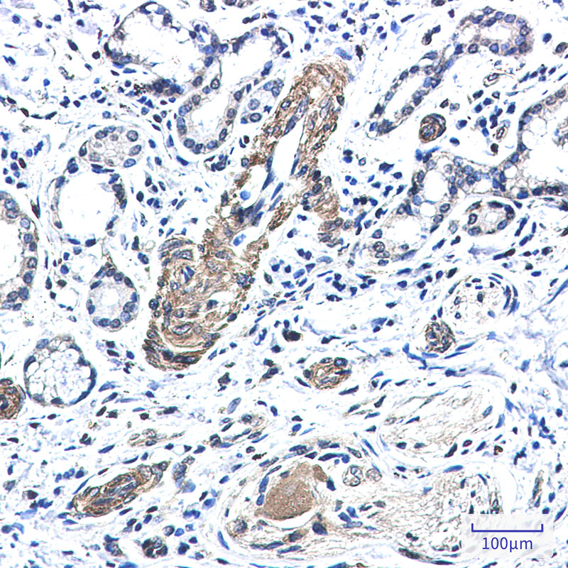 FXR1 Rabbit mAb ABZ2417