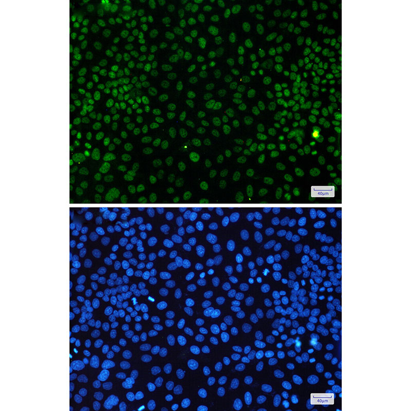 CDK9 Rabbit mAb ABZ2418
