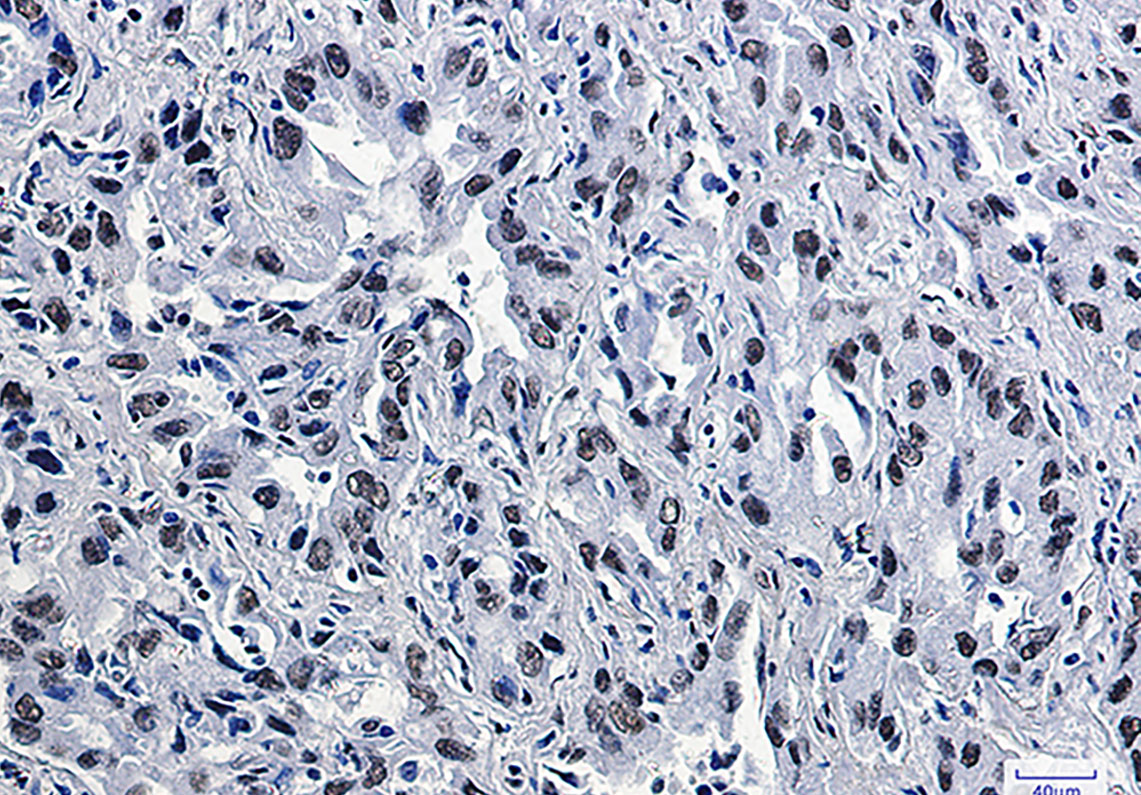 CDK9 Rabbit mAb ABZ2418