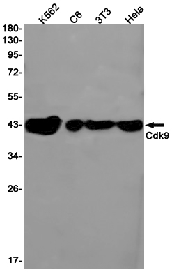 CDK9 Rabbit mAb ABZ2418