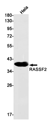 RASSF2 Rabbit mAb ABZ2419