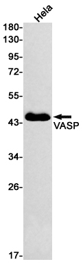 VASP Rabbit mAb ABZ2420