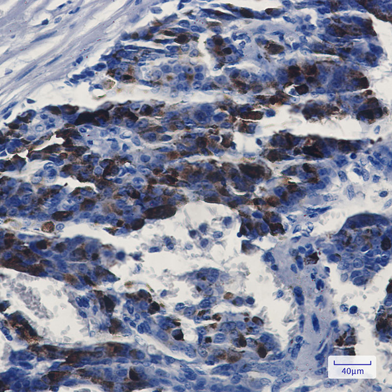 MMP14 Rabbit mAb ABZ2422