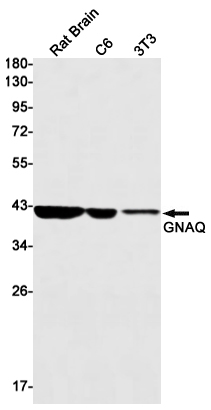 GNAQ Rabbit mAb ABZ2423