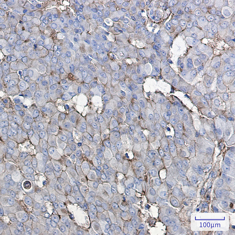 GNAQ Rabbit mAb ABZ2424