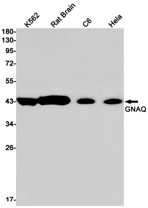GNAQ Rabbit mAb ABZ2424