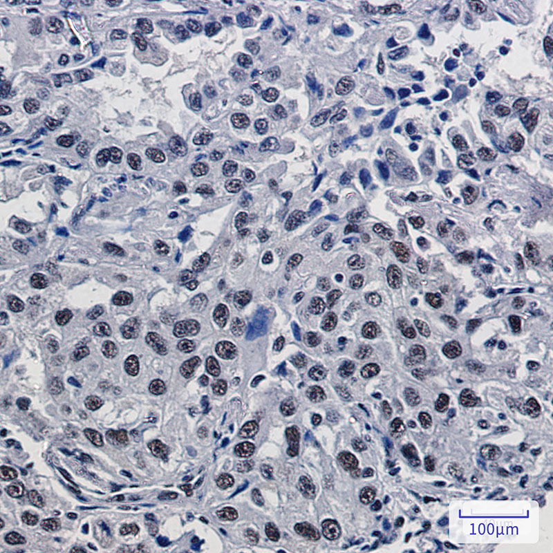 Mre11 Rabbit mAb ABZ2427