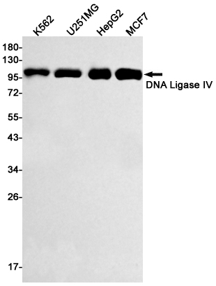 DNA Ligase IV Rabbit mAb ABZ2428
