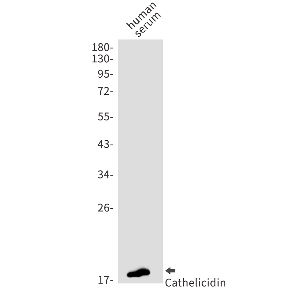 Cathelicidin/CLP Rabbit mAb ABZ2429