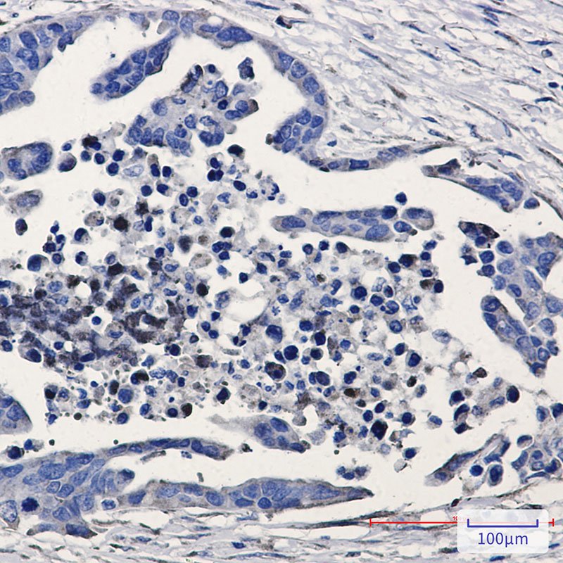 GSK3 beta Rabbit mAb ABZ2430