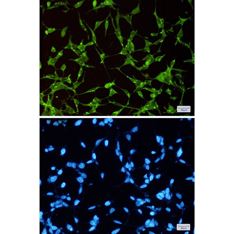 GSK3 alpha Rabbit mAb ABZ2431