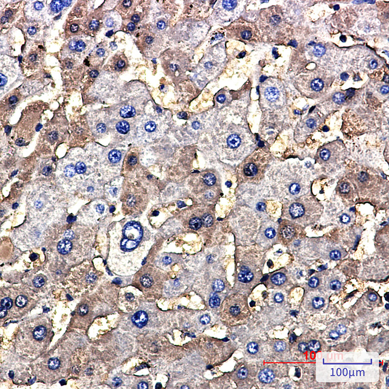 Tuberin Rabbit mAb ABZ2432
