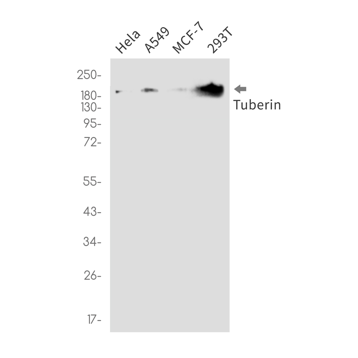 Tuberin Rabbit mAb ABZ2432