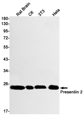 Presenilin 2/AD5 Rabbit mAb ABZ2433